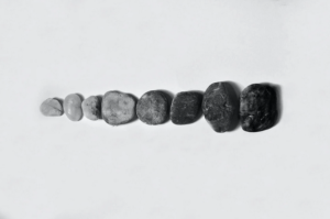 stones